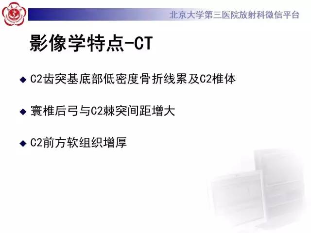 【病例】齿状突骨折1例CT及MR