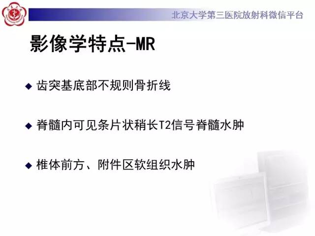 【病例】齿状突骨折1例CT及MR