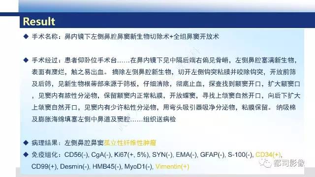 【PPT】鼻腔鼻窦孤立性纤维瘤影像诊断