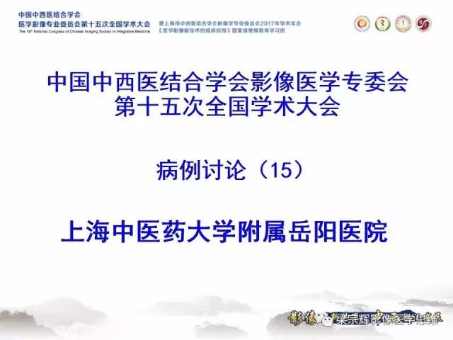 【病例】颅骨尤文氏肉瘤1例MR