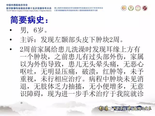 【病例】颅骨尤文氏肉瘤1例MR
