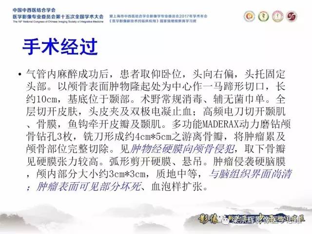 【病例】颅骨尤文氏肉瘤1例MR