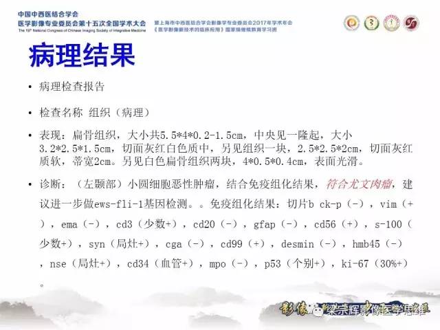 【病例】颅骨尤文氏肉瘤1例MR
