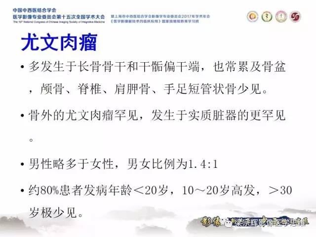 【病例】颅骨尤文氏肉瘤1例MR