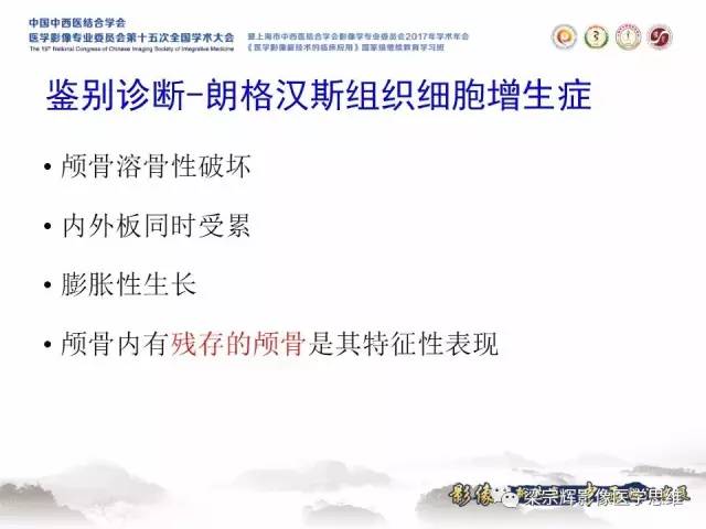 【病例】颅骨尤文氏肉瘤1例MR