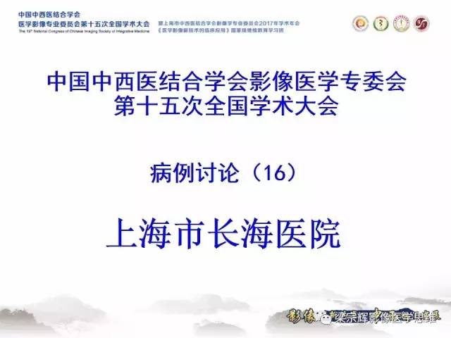 【病例】胰腺实性假乳头状瘤1例MR