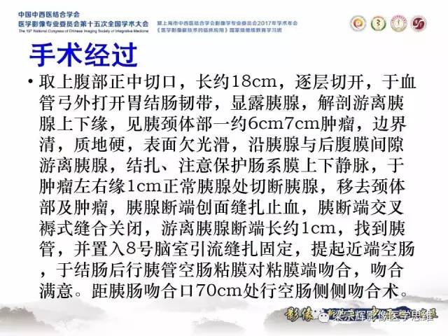 【病例】胰腺实性假乳头状瘤1例MR