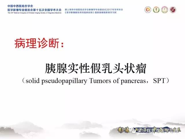 【病例】胰腺实性假乳头状瘤1例MR