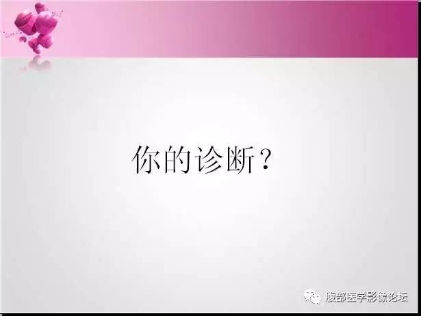 【病例】左侧肾上腺髓样脂肪瘤1例CT及MR