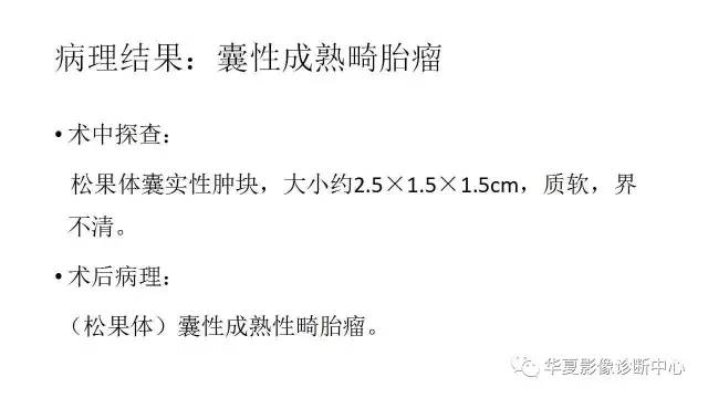 【病例】松果体区畸胎瘤1例CT及MR影像表现