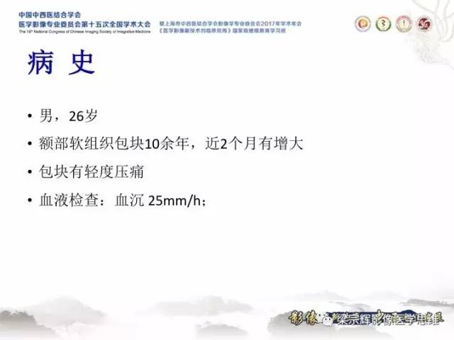 【病例】颅骨嗜酸性肉芽肿1例CT及MR影像表现