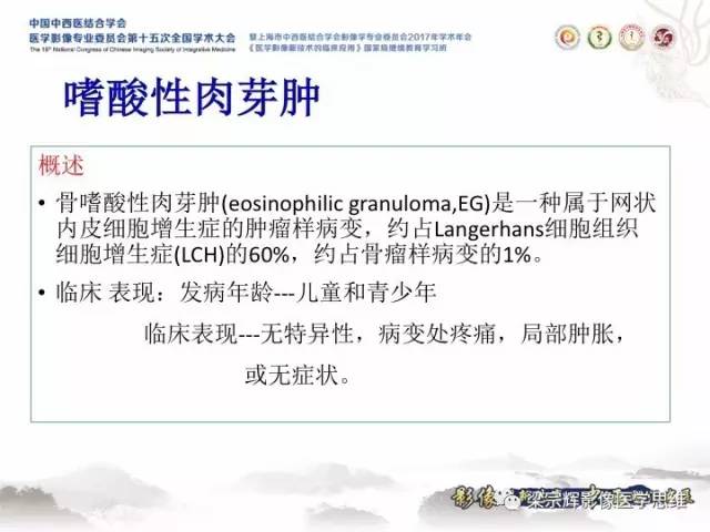 【病例】颅骨嗜酸性肉芽肿1例CT及MR影像表现