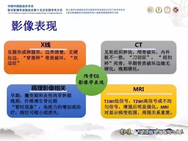 【病例】颅骨嗜酸性肉芽肿1例CT及MR影像表现