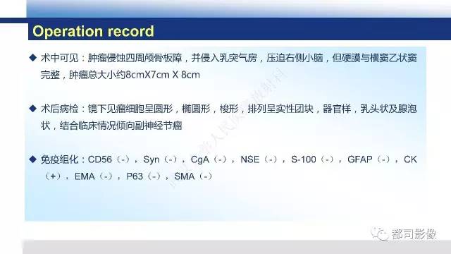 【PPT】头颈部副神经节瘤影像诊断