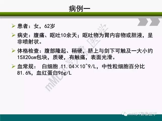 【PPT】胃外生性肿瘤的诊断与鉴别诊断