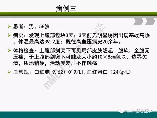 【PPT】胃外生性肿瘤的诊断与鉴别诊断
