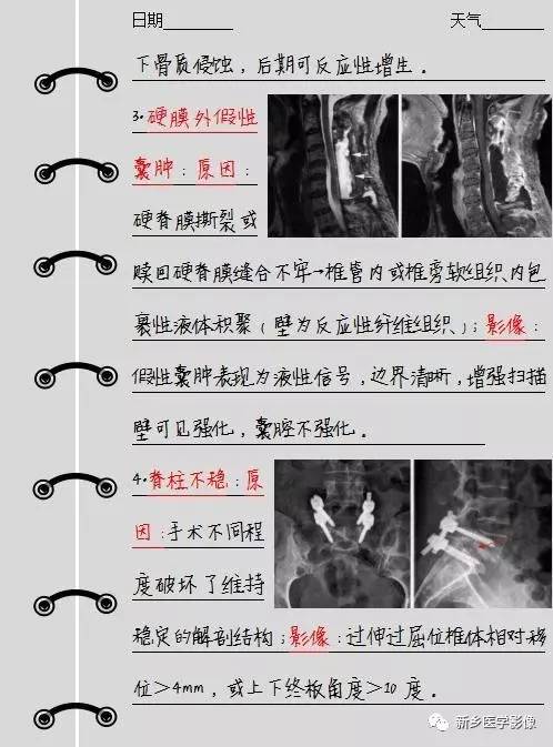 脊柱术后我们需要注意的4个并发症