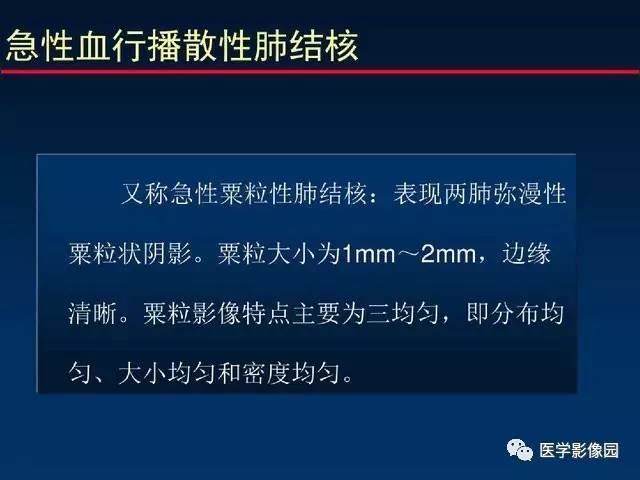 【PPT】血行播散性肺结核的影像诊断与鉴别