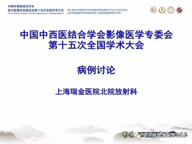 【病例】胸膜孤立性纤维瘤1例CT及MR影像表现