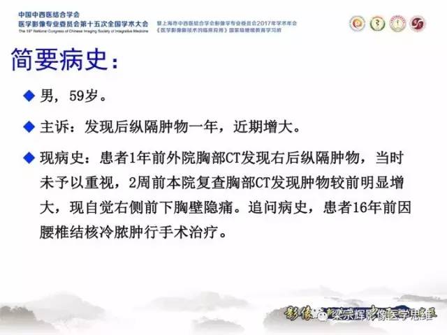 【病例】胸膜孤立性纤维瘤1例CT及MR影像表现
