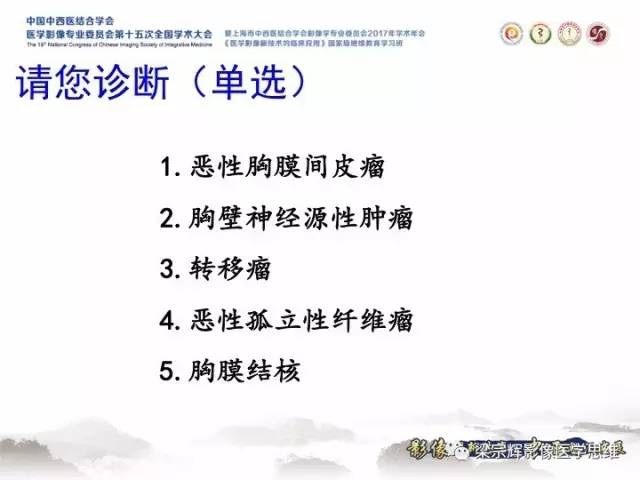 【病例】胸膜孤立性纤维瘤1例CT及MR影像表现