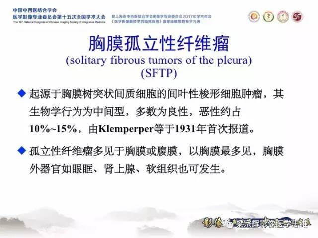 【病例】胸膜孤立性纤维瘤1例CT及MR影像表现