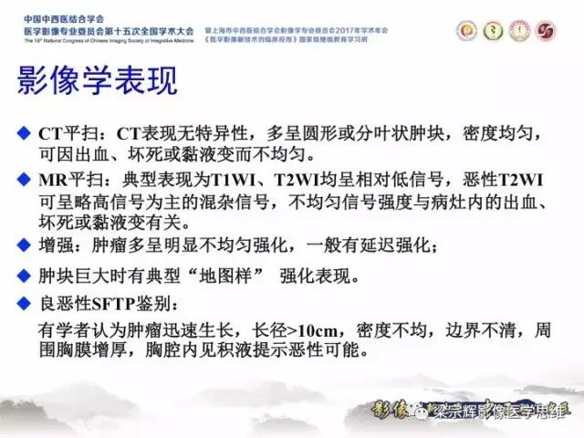 【病例】胸膜孤立性纤维瘤1例CT及MR影像表现