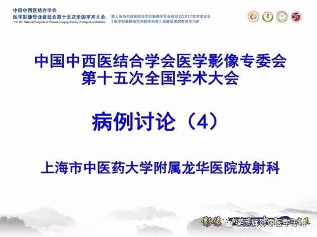 【病例】卵巢纤维肉瘤1例MR影像表现