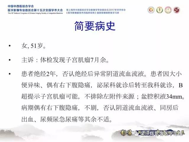 【病例】卵巢纤维肉瘤1例MR影像表现