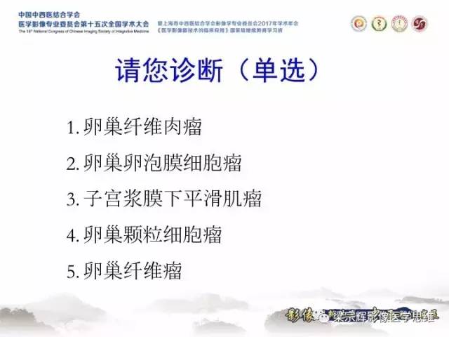 【病例】卵巢纤维肉瘤1例MR影像表现