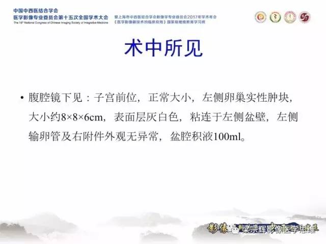 【病例】卵巢纤维肉瘤1例MR影像表现