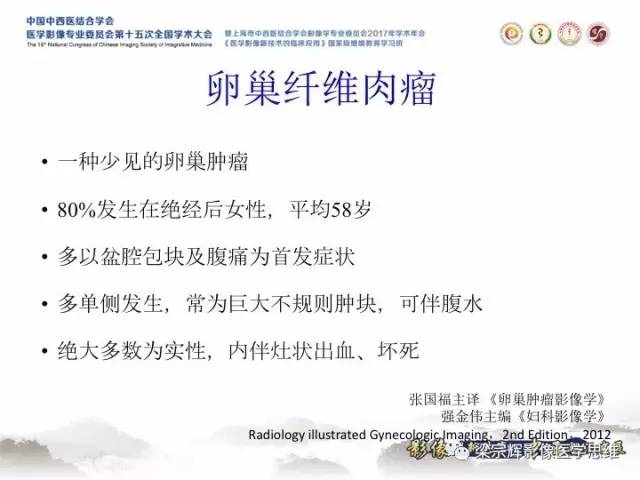 【病例】卵巢纤维肉瘤1例MR影像表现