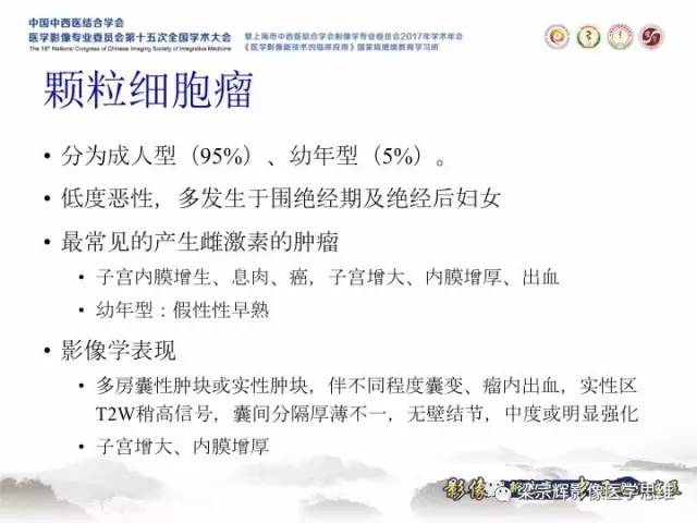 【病例】卵巢纤维肉瘤1例MR影像表现