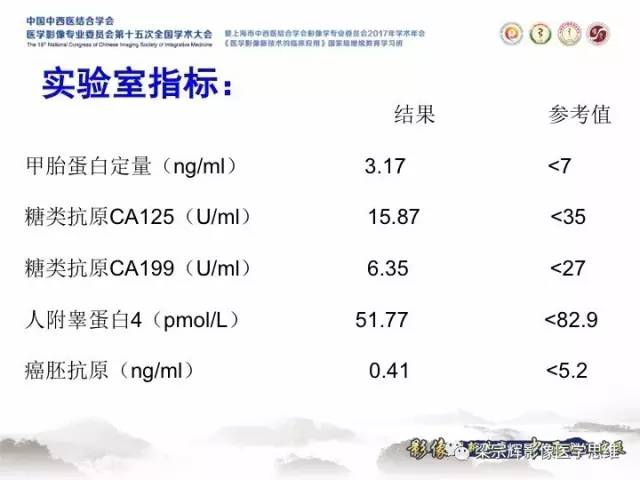 【病例】子宫内膜间质肉瘤1例MR影像表现