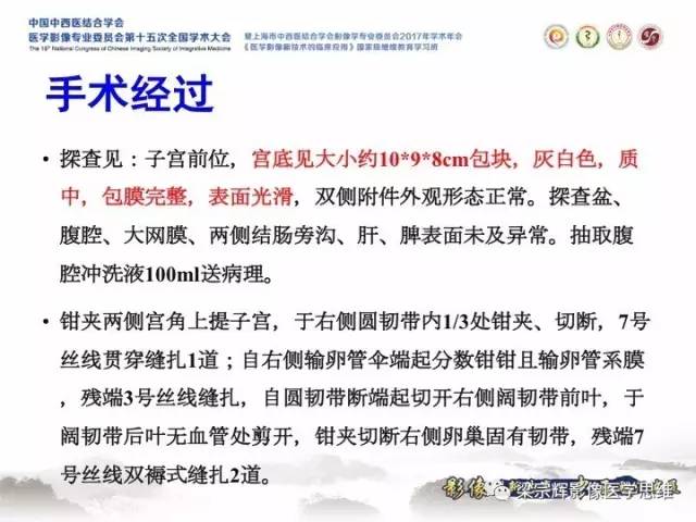 【病例】子宫内膜间质肉瘤1例MR影像表现