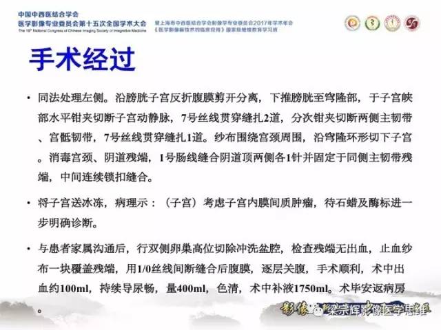 【病例】子宫内膜间质肉瘤1例MR影像表现