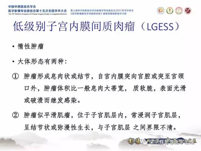 【病例】子宫内膜间质肉瘤1例MR影像表现