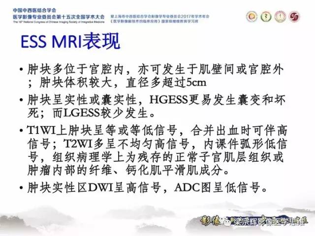 【病例】子宫内膜间质肉瘤1例MR影像表现