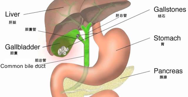 胆囊疾病MRI一键入门 胆囊疾病MRI一键入门