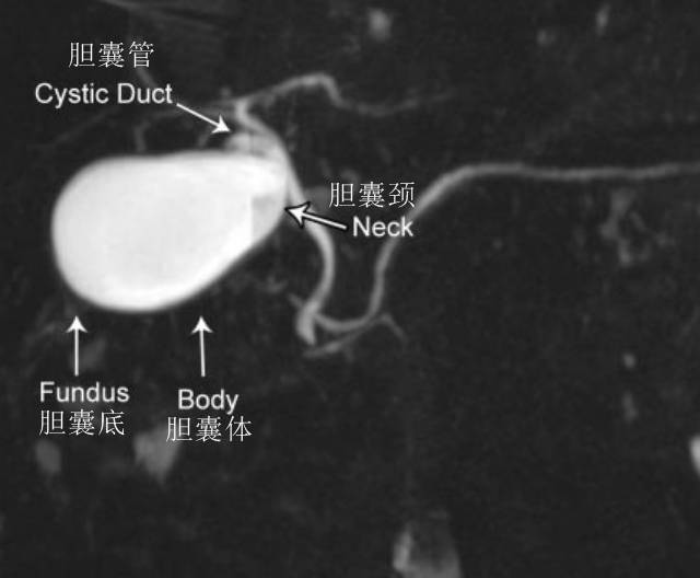 胆囊疾病MRI一键入门 胆囊疾病MRI一键入门