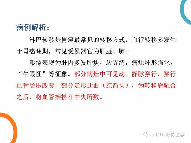 【PPT】肝脏血管穿行征病变影像分析