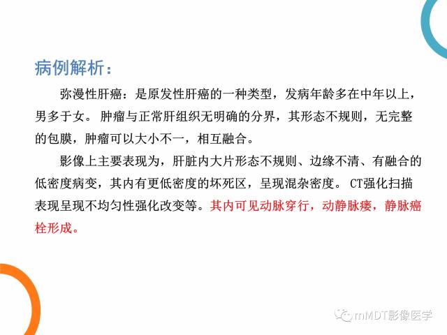 【PPT】肝脏血管穿行征病变影像分析