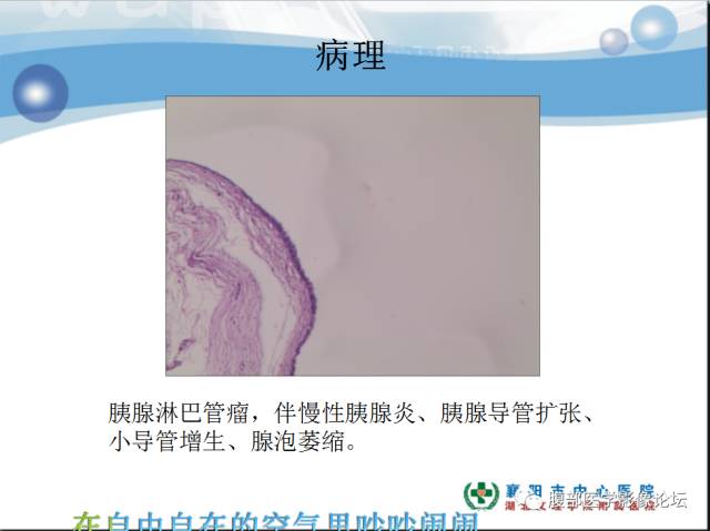 【病例】胰腺淋巴管瘤1例CT影像表现