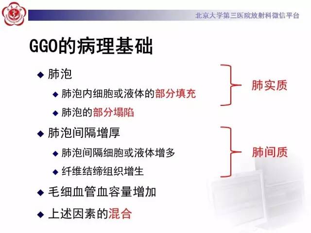 【PPT】磨玻璃密度病变的CT诊断（二）