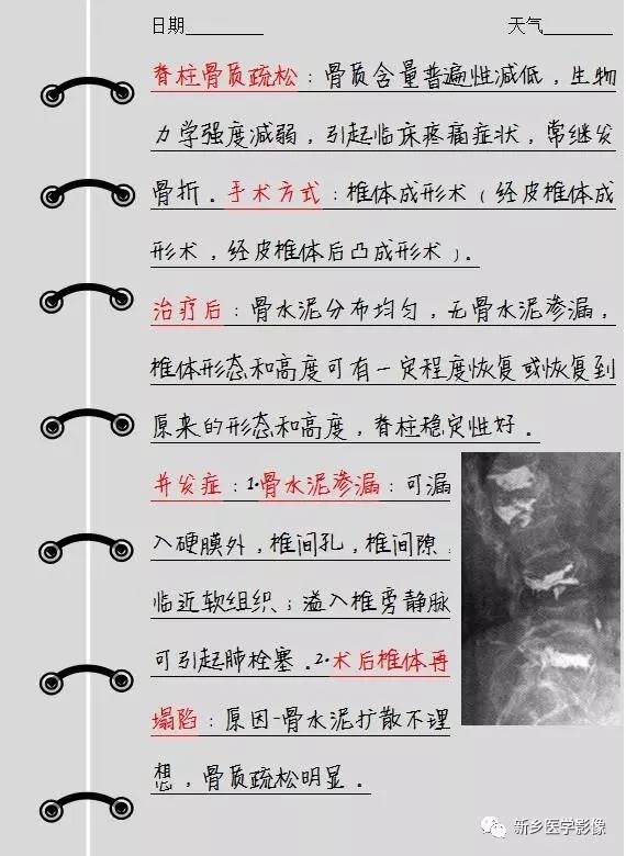 骨水泥注入术后影像报告重点写什么？