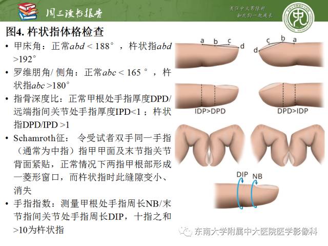 【PPT】肥大性骨关节病临床及影像特征【RG精选】