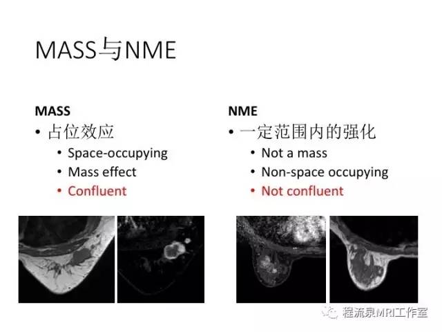 【PPT】乳腺非肿块样强化的鉴别诊断