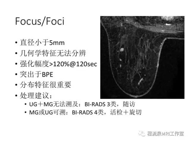 【PPT】乳腺非肿块样强化的鉴别诊断