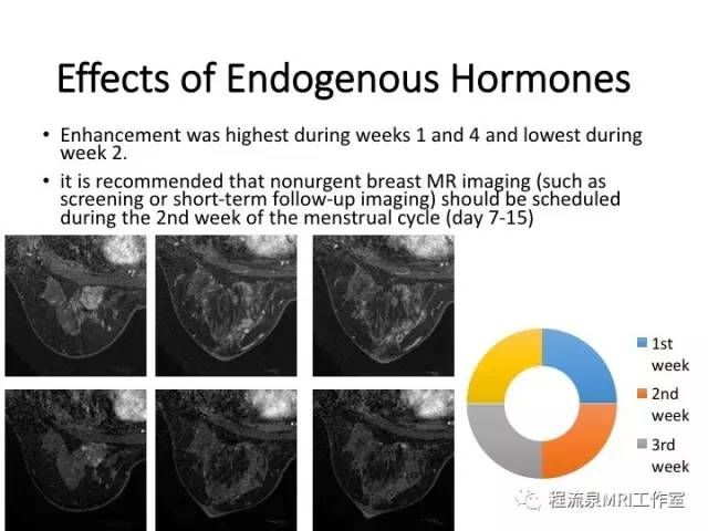 【PPT】乳腺非肿块样强化的鉴别诊断