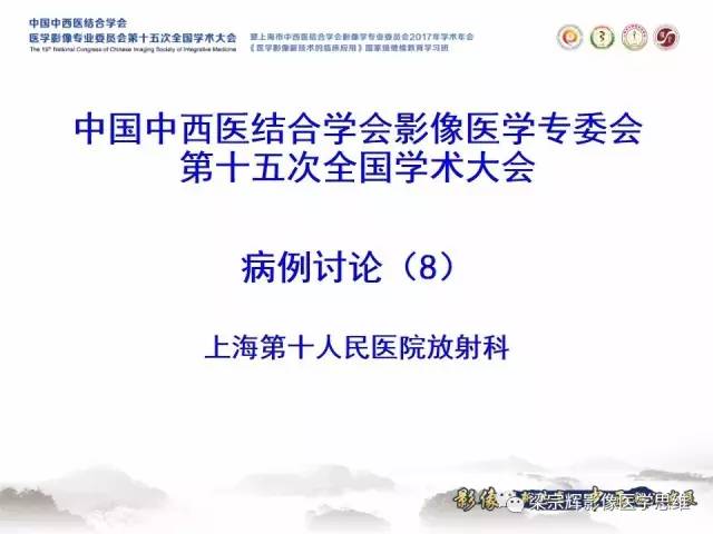 【病例】不典型肝脏海绵状血管瘤1例MR影像表现